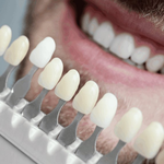 Teeth