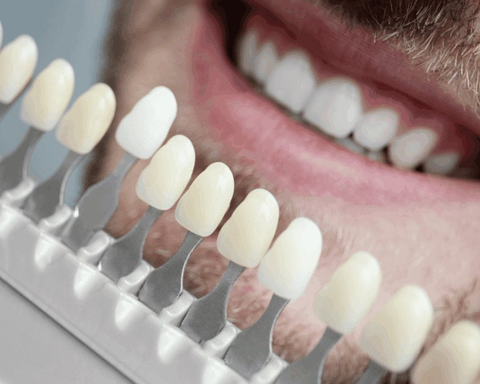 Teeth