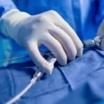 Interventional Radiology Approaches for Treating Endovenous Insufficiency