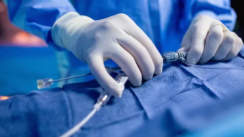 Interventional Radiology Approaches for Treating Endovenous Insufficiency
